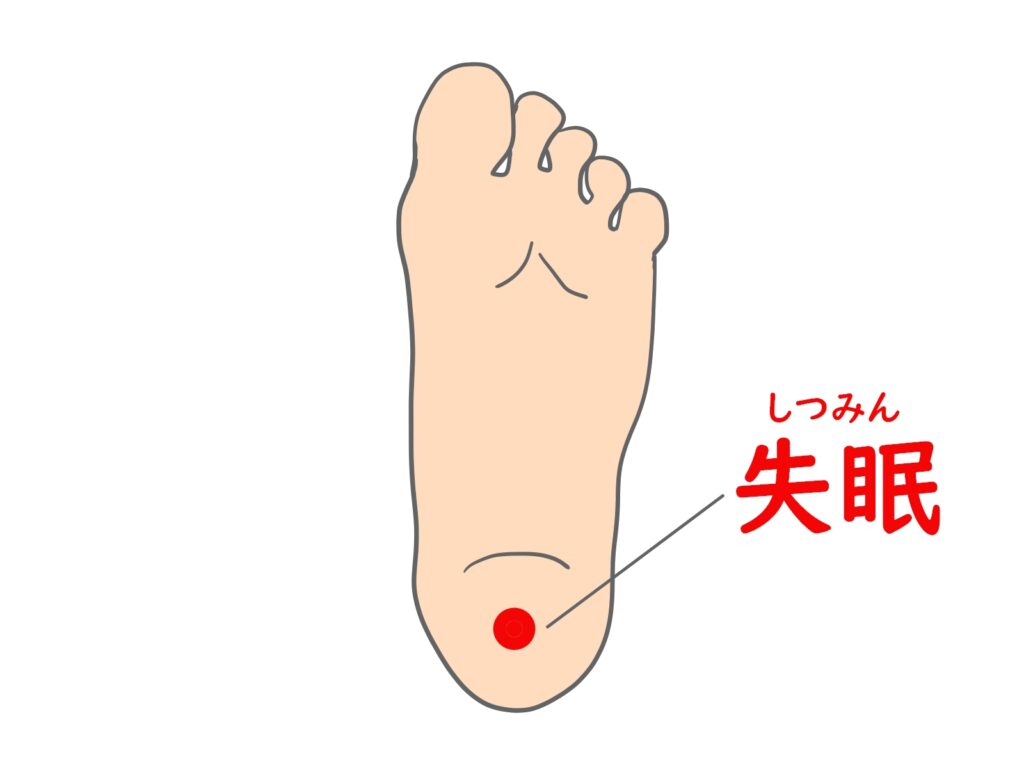 ツボ　失眠