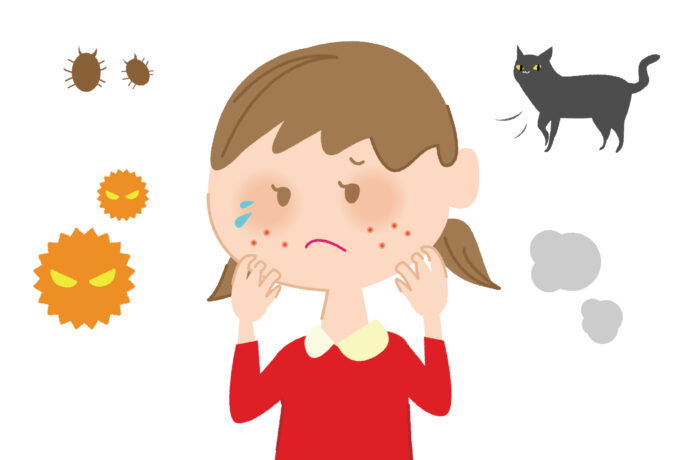 アレルギーの女の子