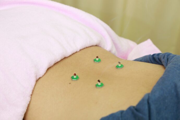 腰にお灸をする